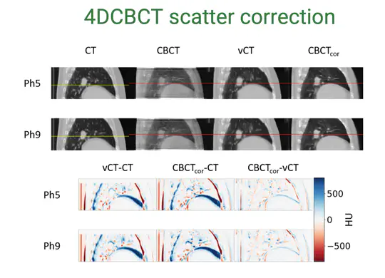 4DCBCT Scatter Correction