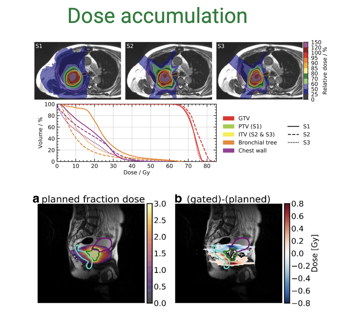 Dose Accumulation | LMU ART Lab