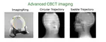 Advanced CBCT Imaging