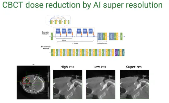 CBCT Dose Reduction with AI Super-Resolution