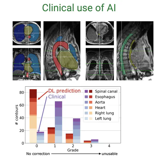 Clinical Use of AI
