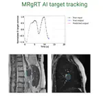 MRgRT AI-based Target Tracking