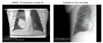 DFG AIM-CBCT-ART