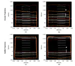DFG Image-guided brachytherapy with real-time navigated needle insertion