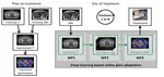 Development of a Deep Learning Toolkit for MRI-Guided Online Adaptive Radiotherapy